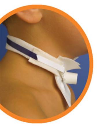 Picture of Tracheostomy Tube Neckband Pedi-Tie®501P