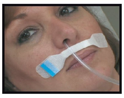 Picture of Nasal Tube Holder NG Secure® 1 X 5 Inch Base, 1.875 X .375 Inch Holder9304-01