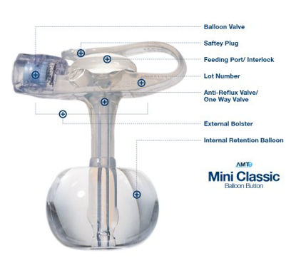 Picture of Balloon Button Gastrostomy Feeding Device AMT MINI Classic 14 Fr. 5 cm Tube Silicone Sterile5-1450