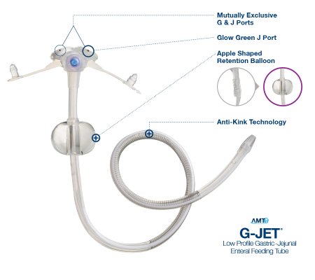 Picture of Low Profile Gastric-Jejunal Enteral Feeding Tube G-JET® 14 Fr. 3.0 / 45 cm Tube SiliconeGJ-1430-45