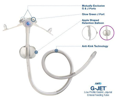 Picture of Low Profile Button Gastrostomy / Jejunal Tube G-JET® 14 Fr. 2 X 30 cm TubeGJ-1420-30