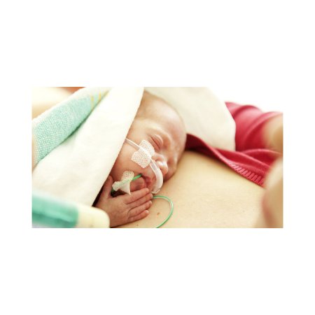 Picture of Neonatal Nasogastric Feeding Tube Medela 8 Fr. 42 Inch Tube PVC SterileENPV4280