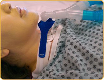 Picture of Anti-Disconnect Ventilation Circuit Marpac Incorporated905D