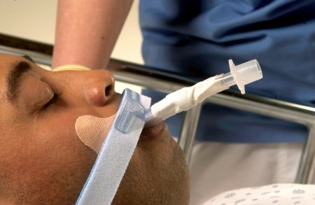 Picture of Endotracheal Tube Holder Stabilock™ Adhesive Tape270