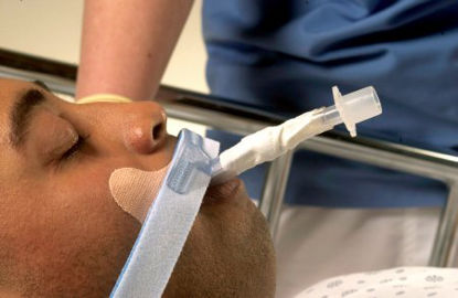 Picture of Endotracheal Tube Holder Stabilock™ Adhesive Tape270