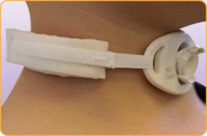 Picture of Tracheostomy Tube Collar205D