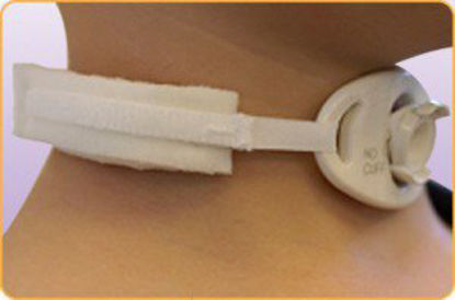 Picture of Tracheostomy Tube Collar205D