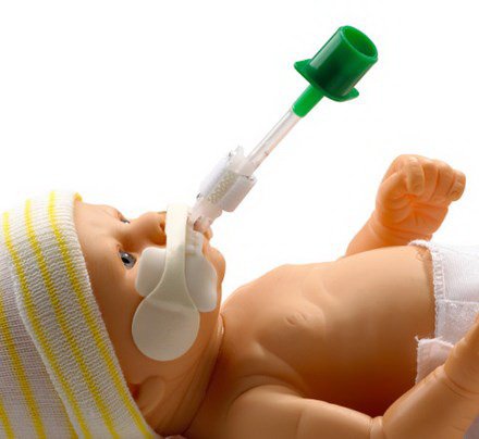 Picture of Neonatal Endotracheal Tube Grip Set NEO-fit™42-2540