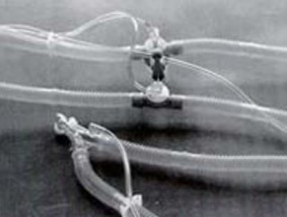 Picture of Puritan Bennett® 7200 Ventilator Circuit Corrugated Tube 72 Inch Tube Dual Limb Adult Without Bag Single Patient Use001793