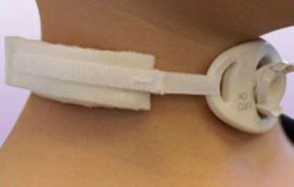 Picture of Tracheostomy Tube Collar100B