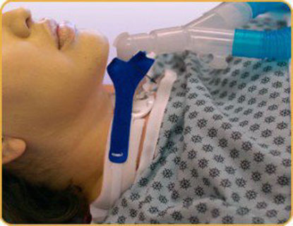 Picture of Vent Circuit Anti-Disconnect Device900D