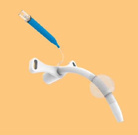 Picture of Cricothyrotomy Catheter Set MelkerG26924