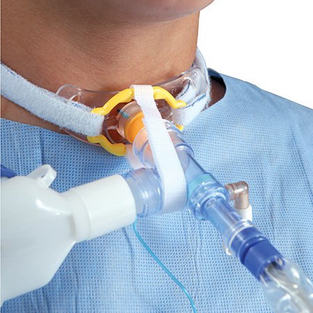 Picture of Tracheotomy Antidisconnect Device TrachStay™103-11270EA