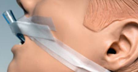 Picture of ET Adhesive Securement Device302D