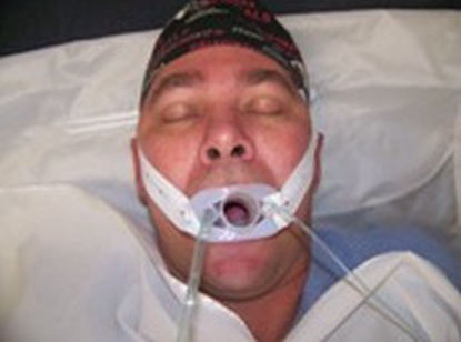 Picture of Anesthesia Breathing Circuit 60 Inch Tube Adult 3 Liter Bag Single Patient Use7-8413-10-62