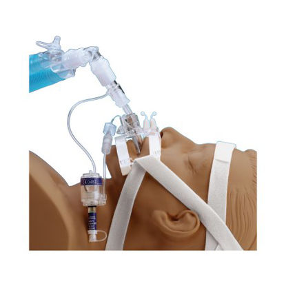 Picture of Endotracheal Tube Holder SecureEasy® Adult NonSterile242003