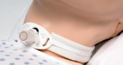 Picture of Tracheostomy Collar204D+7.5