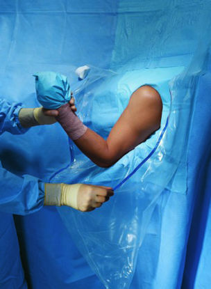 Picture of Orthopedic Drape Shoulder Arthroscopy Drape 160 W X 102 L Inch Sterile89070