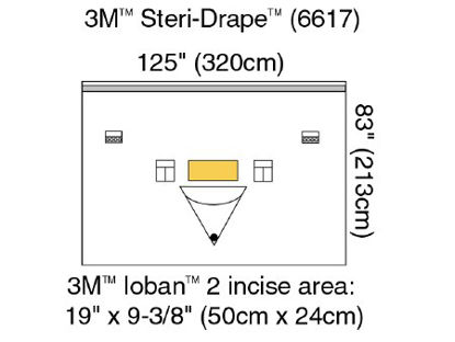 Picture of Orthopedic Drape 3M™ Steri-Drape™ Isolation Drape with Incise and Pouch 125 W X 83 L Inch Sterile6617