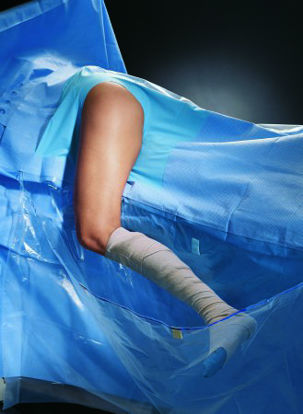 Picture of Orthopedic Drape Hip Drape 116 W X 136 L Inch Sterile89349
