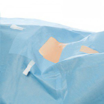 Picture of Abdominal Drape Laparoscopic / Lithotomy Drape 104 W X 35 W X 124 L Inch Sterile29240