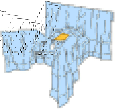 Picture of Obstetrics / Gynecology Drape 3M™ Steri-Drape™ Abdominal-Perineal Lithotomy Position Drape 78 W X 106 L Inch Sterile6665