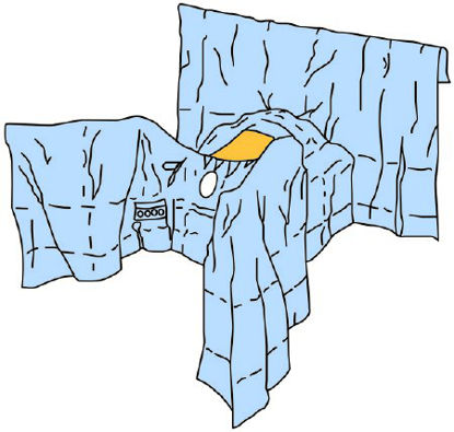 Picture of Obstetrics / Gynecology Drape 3M™ Steri-Drape™ Abdominal-Perineal Lithotomy Position Drape 78 W X 106 L Inch Sterile6665