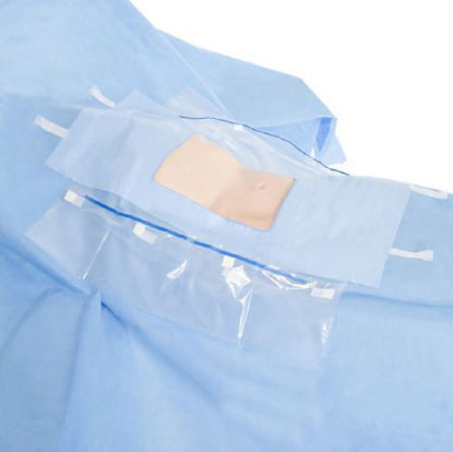 Picture of Abdominal Drape Laparoscopic / Cholecystectomy Drape 104 W X 76 W X 102 L Inch Sterile89538