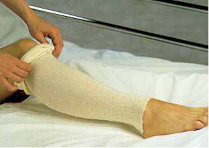 Picture of Stockinette Tubular AlbaHealth® 4 Inch X 25 Yard Cotton NonSterile81420