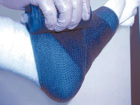 Picture of Cast Tape Delta-Lite® Plus 3 Inch X 12 Foot Fiberglass / Resin Light Blue7345836