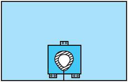 Picture of Orthopedic Drape Pack Convertors®29365