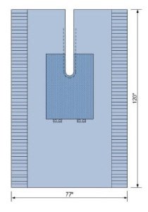 Picture of Orthopedic Drape Split Sheet 77 W X 120 L Inch Sterile19151