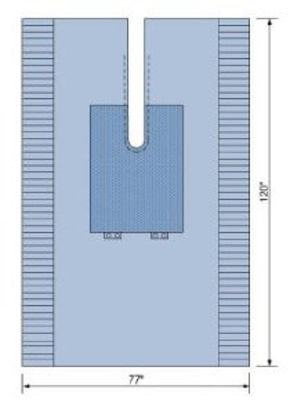 Picture of Orthopedic Drape Split Sheet 77 W X 120 L Inch Sterile19151