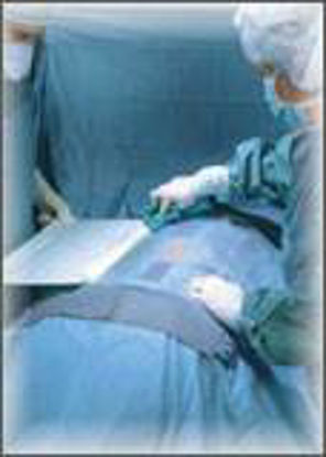 Picture of Orthopedic Drape TMJ Uni-Lateral Drape Body Drape: 77 X 78 Inch, Head Drape: 77 X 55-1/2 Inch3982