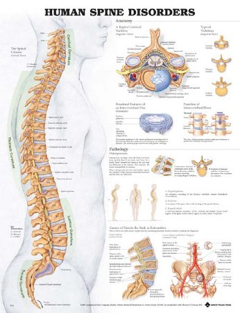 Picture of Anatomical Chart Human Spine Disorders 20 X 26 Inch Plastic Wall Mount Laminated9781587794438
