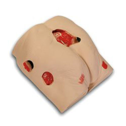 Picture of Wound Care Model Seymour IISB46502