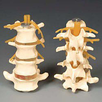 Picture of Budget Lumbar SetCHLS4