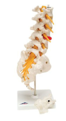 Picture of Anatomical Model 3B® Prolapsed Lumbar Section 3 lbs.12-4543