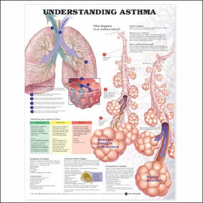 Picture of Chart Understanding Asthma 20 X 26 Inch Paper Laminated9781587799389