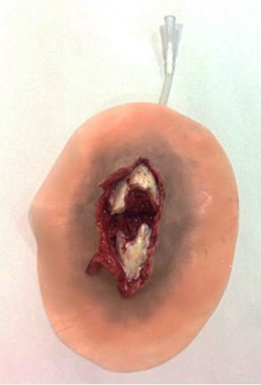 Picture of Moulage Xtreme Open Tibia Fracture Plastic800-011