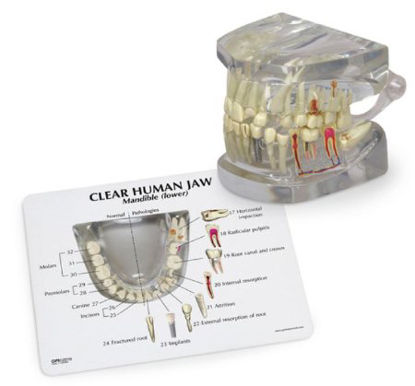 Picture of Clear Human Jaw with Teeth Galloway Plastics®SB48717