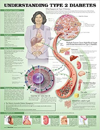 Picture of Anatomical Chart Type 2 Diabetes 20 X 26 Inch Heavy Paper Grommets Laminated9781469894980