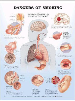Picture of Anatomical Chart Dangers of Smoking 20 X 26 Inch Plastic Wall Mount Laminated9781587792311