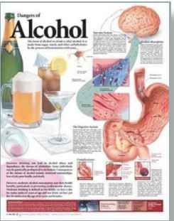 Picture of Anatomical Chart Dangers of Alcohol 20 X 26 Inch Heavy Paper Grommets Laminated9780781782395