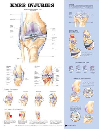 Picture of Anatomical Chart Knee Injuries 20 X 26 Inch Heavy Paper Laminated9781587797576