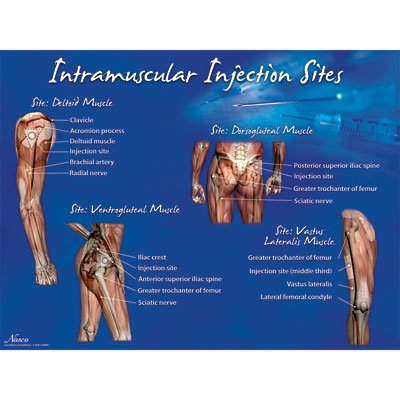 Picture of Educational Poster Intramuscular Injection Sites Training Poster 18 X 24 Inch Heavy Paper Grommets LaminatedLF00695