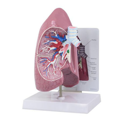 Picture of Lung Model 3B Scientific®Z02804