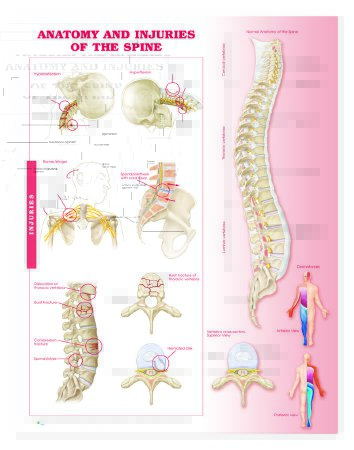 Picture of Anatomical Chart Anatomy and Injuries of the Spine 20 X 26 Inch Heavy Paper Grommets Laminated9780781786676