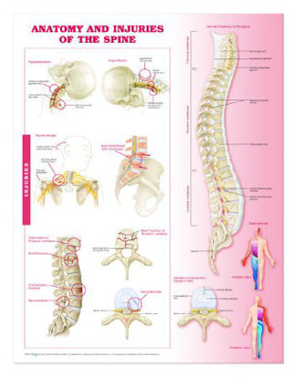 Picture of Anatomical Chart Anatomy and Injuries of the Spine 20 X 26 Inch Heavy Paper Grommets Laminated9780781786676