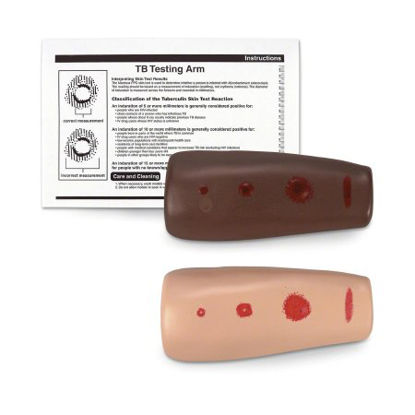 Picture of TB Testing ArmSB25973